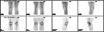 Figure 11B