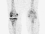 Figure 11C