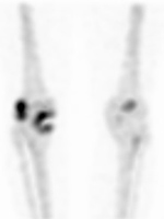 Figure 12 C