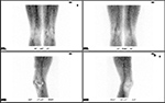 Figure 13B