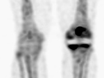 Figure 13C