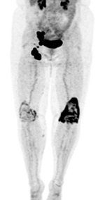 Figure 15A