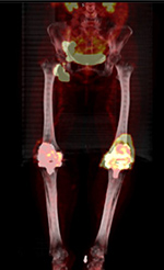 Figure 15B