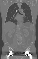Figure 16A