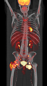 Figure 17B