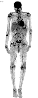 Figure 17C