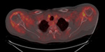 Figure 17D