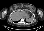 Figure 21B