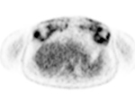 Figure 21C