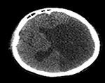 Figure 23A