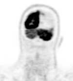 Figure 23D