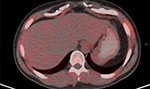 Figure 24C