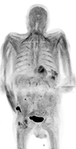 Figure 25A