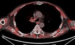 Figure 25B