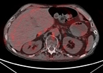 Figure 25C
