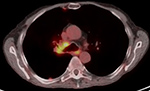 Figure 25E