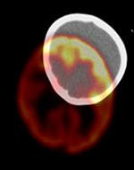 Figure 27C