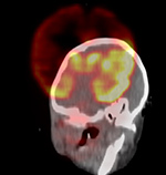 Figure 27D