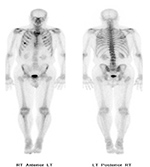 Figure 35B