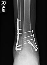 Figure 9A