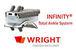 Infinity total ankle system