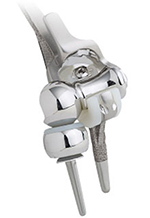 Latitude EV elbow prosthesis