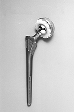 Modular non-cemented hip prosthesis