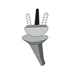 Fourth generation wrist arthroplasty