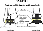 SALTO TAR