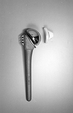 Shoulder prosthesis
