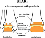 STAR TAR
